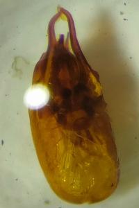 Anotylus rugosus